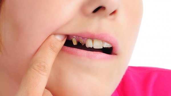 牙痛停滴丸（松柏）的功效与作用是什么 牙痛停滴丸的使用方法