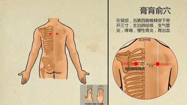 中醫(yī)能把生殖器皰疹治療斷根嗎