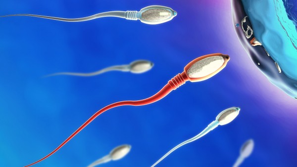 精子畸形y染色体异常