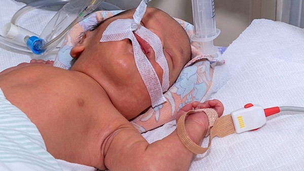 新生儿缺铁性贫血是少于多少