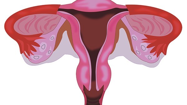 子宫输卵管造影可以看出宫腔粘连吗