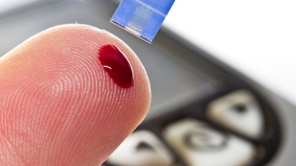 2型糖尿病能吃芭蕉吗