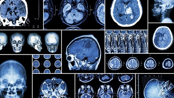 安脑丸对大脑的好处有哪些  安脑丸效果好吗