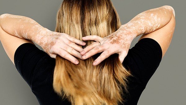 现在无症状和阳性居家隔离几天解封?2022最新疫情防控新十条隔离政策