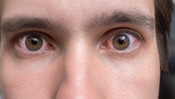 止血祛瘀明目片用于眼底出血的用量是怎样呢？