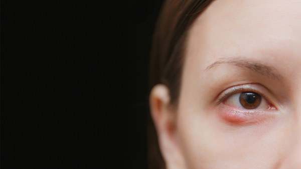 眼睛用药有讲究 对眼睛有好处的药