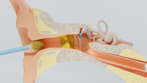 正确处理耳朵聋的三个方法揭晓 耳聋通窍丸抗病毒吗