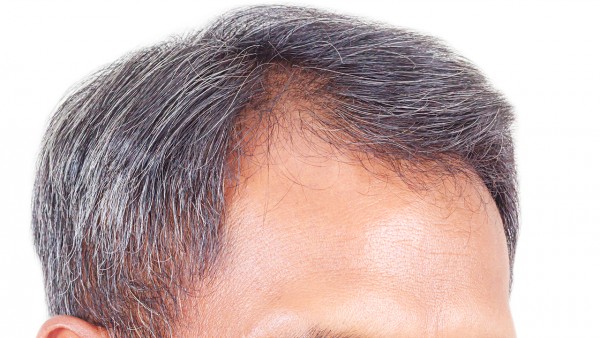 服用滋补生发片能长出很多头发吗?