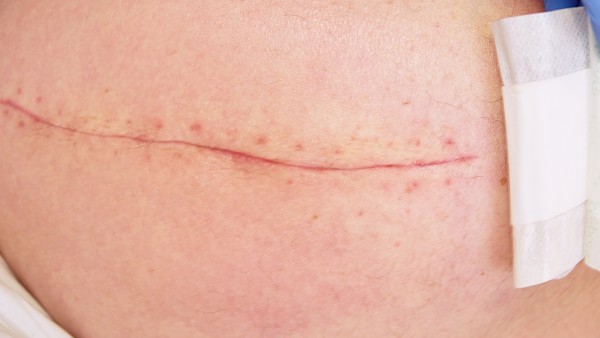 84消毒液哪个牌子好,酒精消毒液怎么选