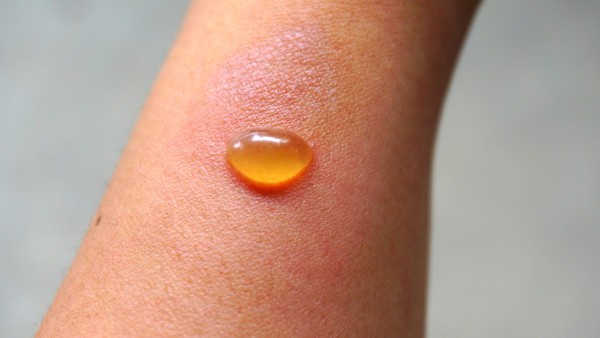 雙氧水泡耳朵要多久,先用雙氧水再用生理鹽水清洗耳朵可洗手