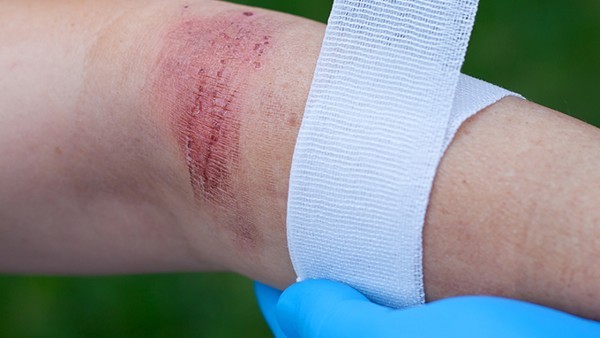 蒲黄炒多久,黄蒲:一定要煮熟才能吃!