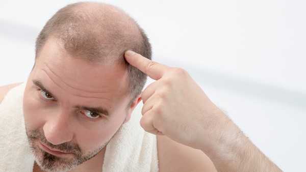 治疗脱发多久有效果,如何治疗脱发?