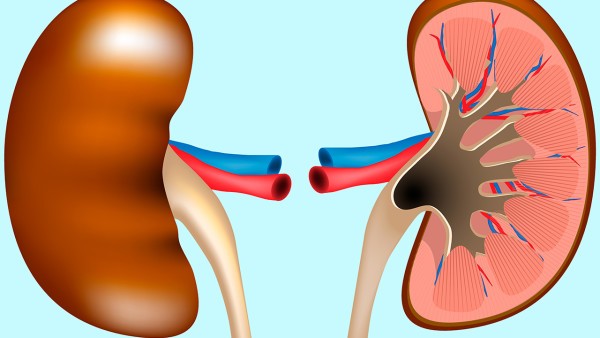 多发双肾囊肿能活多久,多囊肾可分两种类型