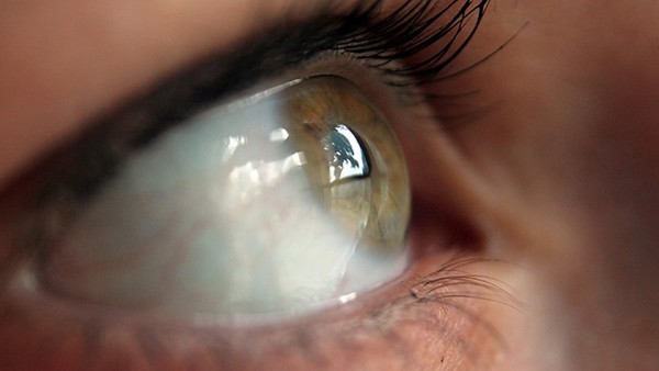 眼肌麻痹多久能够回复,眼球震颤可戴三棱镜或眼镜改善症状