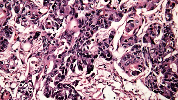 抗病毒口服液和双黄连哪个好 抗病毒口服液治新冠有用吗