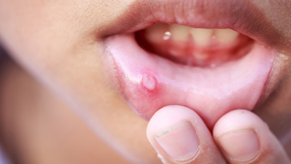 儿童发热  布洛芬和对乙酰氨基酚交替使用好吗