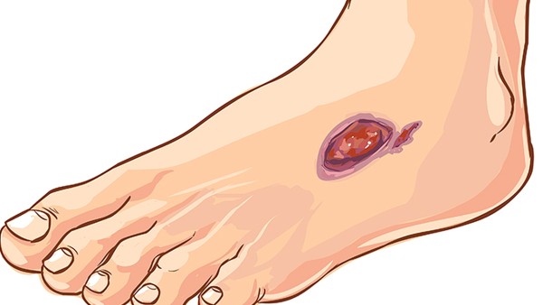 口服补液盐的用法用量是怎样的？口服补液盐散的作用与功效