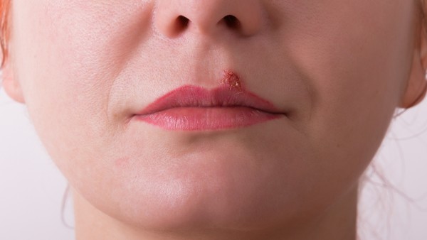 對乙酰氨基酚口服溶液的老年患者用藥是怎樣呢？