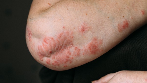 这些“伪神药”你还在信吗 新冠期间如何用药你知道哪些