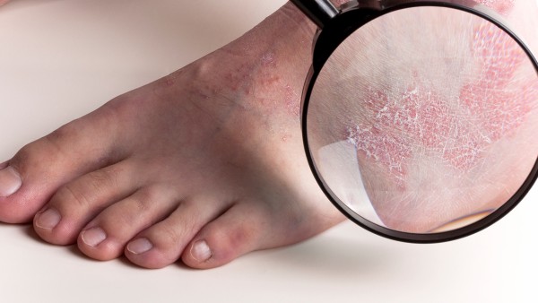 四季抗病毒膠囊和蓮花清瘟哪個比較好？四季三黃軟膠囊與連花清瘟膠囊可以一起吃嗎