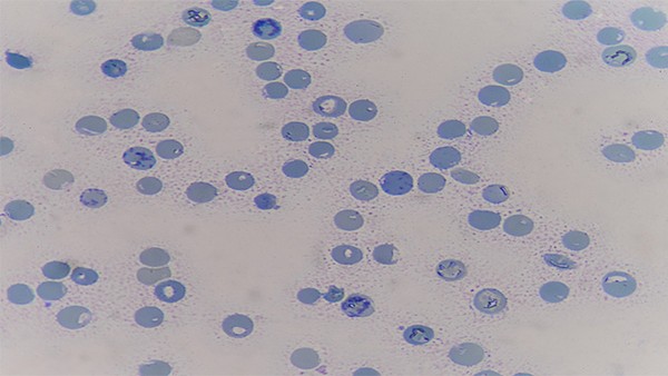 诺如病毒蒙脱石散止吐吗 诺如病毒呕吐怎么用药治疗