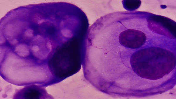 振東泰盛布洛芬片對新冠有治療作用嗎 被瘋傳的新冠吃藥順序圖，真的靠譜嗎？本文講出實情|退熱藥|布洛芬|抗病毒|對癥|治療|2019冠狀病毒病