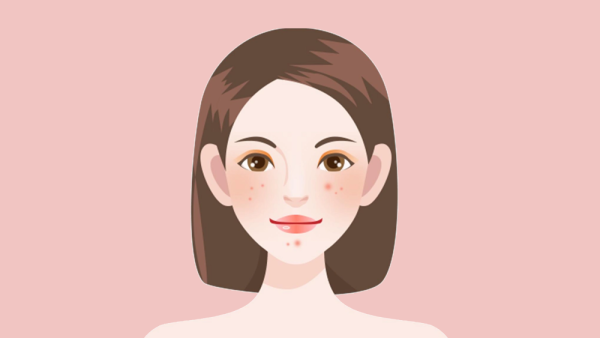 炉甘石洗剂对于痤疮是比较有效果的吗？