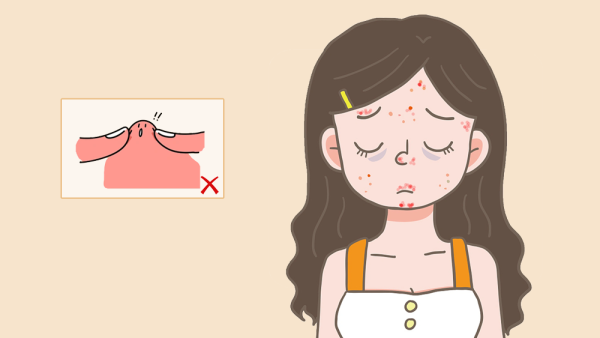 臉上起了痤瘡怎么辦 復(fù)方珍珠暗瘡片與連花清瘟膠囊可以一起吃嗎