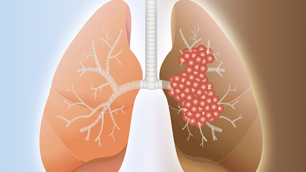 新冠肺炎治愈后有后遗症吗 中一牌妇炎消泡腾片可以治疗新冠肺炎吗