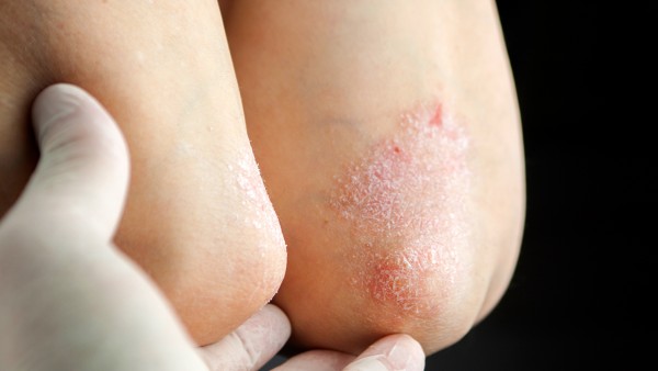 东盛抗病毒口服液能不能预防感冒 东盛抗病毒口服液能和抗病毒口服液一起吃吗