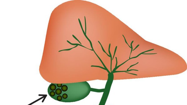 肝络欣丸治疗慢性乙型肝炎效果好吗？