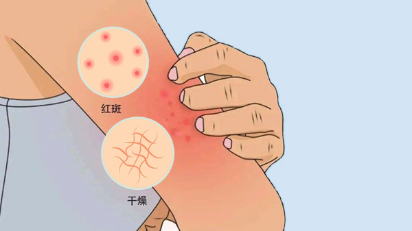 什么时候吃皮肤病血毒丸效果最好？