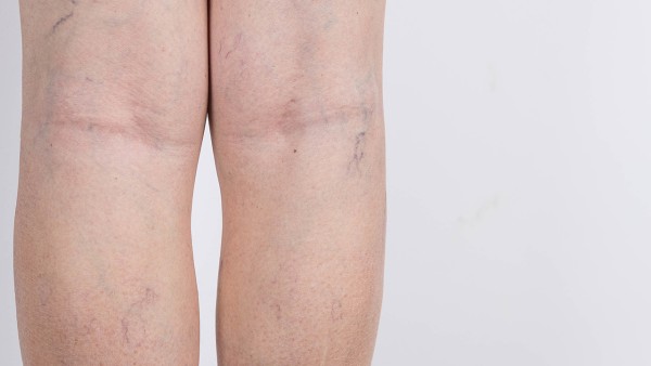 金莲清热泡腾片能和蒲地蓝消炎片一起吃吗 服用金莲清热泡腾片的功能和该注意什么？