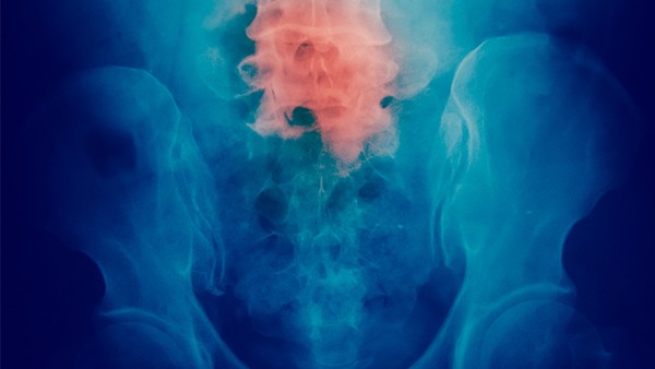 清肺十八味丸的效果好吗？有什么特点？