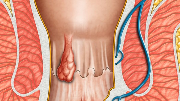 脂必妥片的成分有哪些 脂必妥片有什么功效?