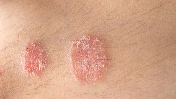 对乙酰氨基酚口服混悬液是抗病毒的药吗 孕妇可以喝小孩的退烧药吗