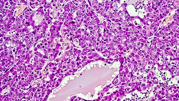 奥硝唑片的功效有什么呢？