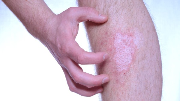 服用复方氨肽素片需要注意些什么