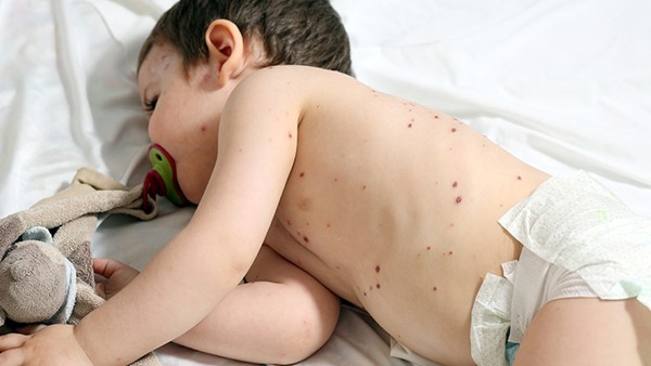 肾功能受损的患者怎么用药 使用百令片效果好吗