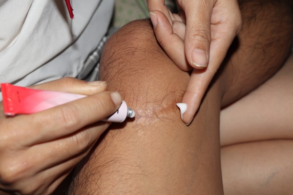 正金油软膏的功效 正金油是处方药吗?