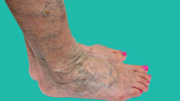 血塞通滴丸功效怎么樣呢？能長期服用嗎？