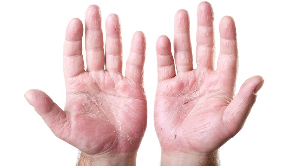 阿司匹林泡腾片能和乙酰氨基酚片一起吃吗 对乙酰氨基酚片与哪些药不宜同时使用