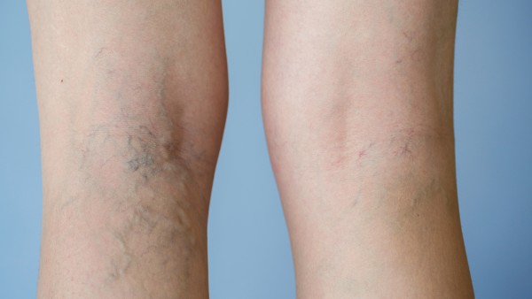 三磷酸腺苷二钠片具体有哪些功效？