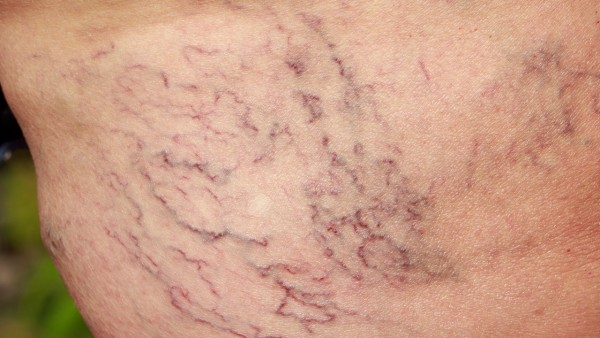 迈之灵片生产厂家是什么呢?规格怎样呢?