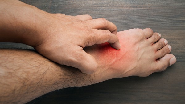 带状疱疹患者可以服用环孢素口服溶液吗？环孢素口服溶液的功效是什么?