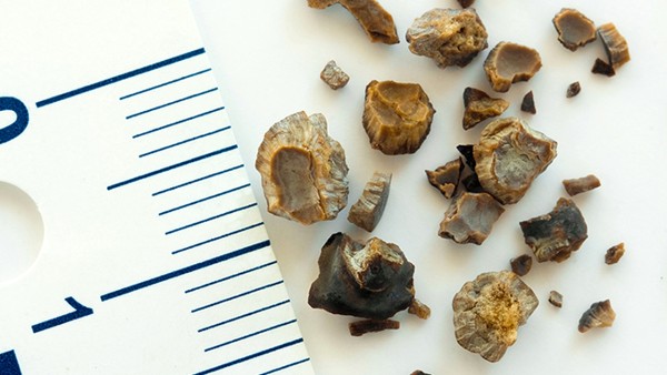 抗骨增生丸生产厂家是什么？