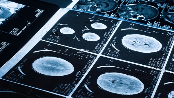 服用清音丸抗病毒吗 嗓子里有透明的小泡泡怎么回事